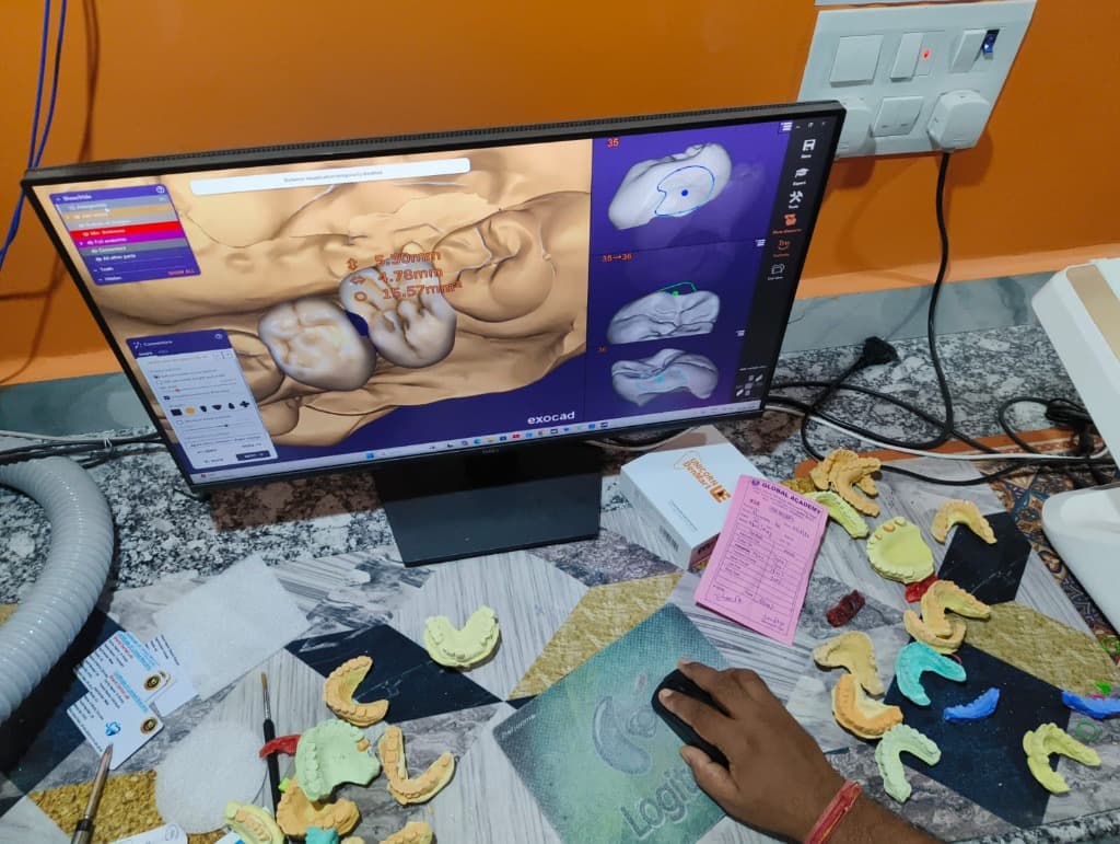 Exocad CAD Design Station